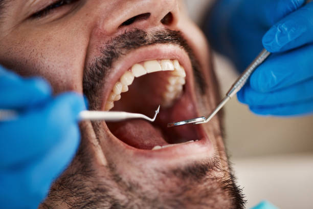 Best Dentist for Tooth Abscess  in Canterwood, WA